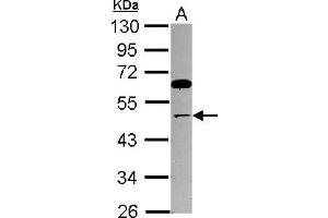 Western Blotting (WB) image for anti-Thyroid Hormone Receptor Interactor 13 (TRIP13) (AA 32-315) antibody (ABIN1501509) (TRIP13 Antikörper  (AA 32-315))