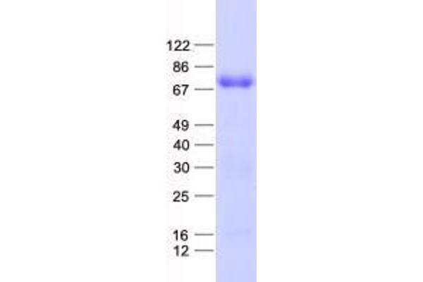 ZNF655 Protein (His tag)