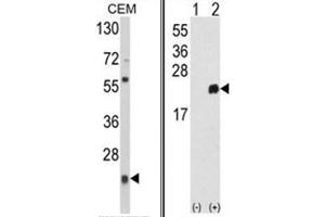 (LEFT) Western blot analysis of PRDX1 Antibody (Center) in CEM cell line lysates (35ug/lane). (Peroxiredoxin 1 Antikörper  (Middle Region))