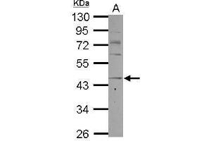 CCR8 Antikörper  (C-Term)