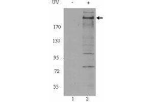 Western Blotting (WB) image for anti-Ataxia Telangiectasia Mutated (ATM) (phosphorylated) antibody (ABIN2666314) (ATM Antikörper  (phosphorylated))