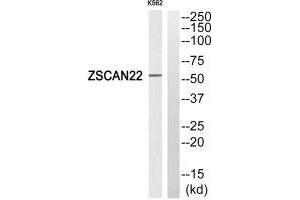 Western blot analysis of extracts from K562 cells, using ZSCAN22 antibody. (ZSCAN22 Antikörper)