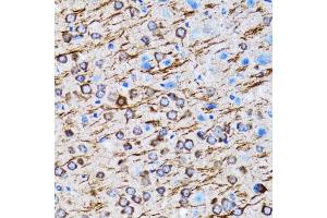 Immunohistochemistry of paraffin-embedded rat brain using MLC3A antibody (ABIN6134219, ABIN6143466, ABIN6143468 and ABIN6215215) at dilution of 1:100 (40x lens). (MAP1LC3A Antikörper  (AA 1-100))
