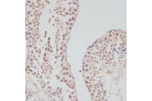 Immunohistochemistry of paraffin-embedded mouse testis using Cyclin G1 antibody (ABIN6127734, ABIN6138095, ABIN6138096 and ABIN6220906) at dilution of 1:100 (40x lens). (Cyclin G1 Antikörper  (C-Term))