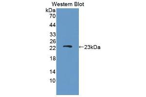 Figure. (DISC1 Antikörper  (AA 151-330))