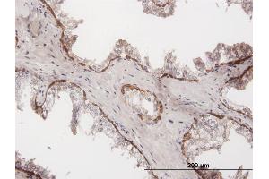 Immunoperoxidase of purified MaxPab antibody to KRT15 on formalin-fixed paraffin-embedded human prostate. (KRT15 Antikörper  (AA 1-456))