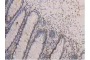 IHC-P analysis of Human Rectum Tissue, with DAB staining. (PCNA Antikörper  (AA 6-261))