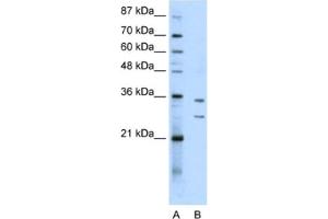 Western Blotting (WB) image for anti-Brix Domain Containing 5 (RPF1) antibody (ABIN2462306) (RPF1 Antikörper)