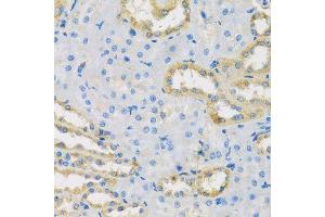 Immunohistochemistry of paraffin-embedded rat kidney using HS1BP3 antibody. (HS1BP3 Antikörper  (AA 1-200))