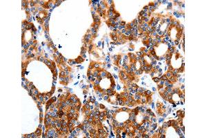 Immunohistochemistry (IHC) image for anti-Hyperpolarization Activated Cyclic Nucleotide-Gated Potassium Channel 1 (HCN1) antibody (ABIN3023439) (HCN1 Antikörper)