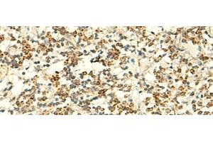 Immunohistochemistry of paraffin-embedded Human tonsil tissue using IFT27 Polyclonal Antibody at dilution of 1:50(x200) (RABL4 Antikörper)