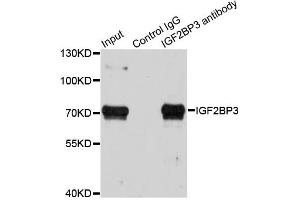 Immunoprecipitation analysis of 100ug extracts of HepG2 cells using 3ug IGF2BP3 antibody.