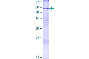 Image no. 1 for Asparagine-Linked Glycosylation 9, alpha-1,2-Mannosyltransferase (ALG9) (AA 1-618) protein (GST tag) (ABIN1344886) (ALG9 Protein (AA 1-618) (GST tag))