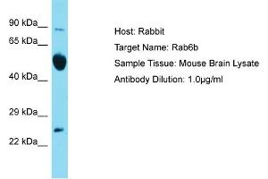 Host: Rabbit Target Name: Rab6b Sample Type: Mouse Brain lysates Antibody Dilution: 1. (RAB6B Antikörper  (C-Term))