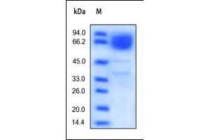 SDS-PAGE (SDS) image for CD36 (CD36) (AA 30-439) protein (His tag) (ABIN2180762) (CD36 Protein (CD36) (AA 30-439) (His tag))