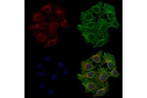 ABIN6258317 and ABIN6274726 staining HepG2 cells by IF/ICC. (MRPL10 Antikörper  (C-Term))