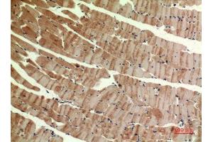 Immunohistochemistry (IHC) image for anti-MutY Homolog (E. Coli) (MUTYH) (pan) antibody (ABIN3187926)