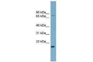 WB Suggested Anti-PDZRN4 Antibody Titration:  0.