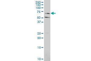 SLCO2A1 polyclonal antibody (A01), Lot # 060529JCS1 Western Blot analysis of SLCO2A1 expression in HL-60 . (SLCO2A1 Antikörper  (AA 276-325))