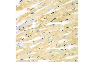 Immunohistochemistry of paraffin-embedded rat heart using PDE4DIP antibody at dilution of 1:100 (40x lens).