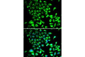 Immunofluorescence analysis of U2OS cells using SSBP1 antibody (ABIN5974202). (SSBP1 Antikörper)