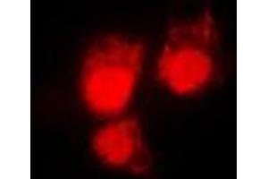 Immunofluorescent analysis of CDC2 (pT161) staining in HeLa cells.