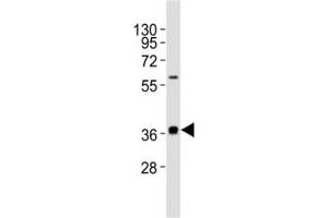 Western blot testing of MICA antibody at 1:1000 dilution + HeLa lysate (MICA Antikörper  (AA 68-97))