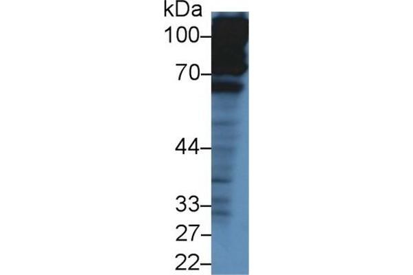 Complement Factor H Antikörper  (AA 915-1156)