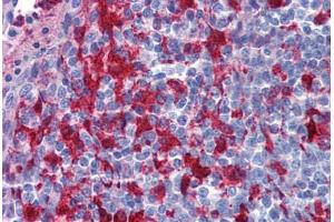 Human Tonsil: Formalin-Fixed, Paraffin-Embedded (FFPE) (Gelsolin Antikörper  (AA 542-591))