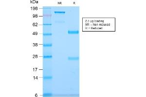 SDS-PAGE Analysis Purified CD79b Recombinant Rabbit Monoclonal Antibody (IGB/2940R). (Rekombinanter CD79b Antikörper  (AA 29-159))