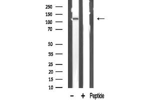anti-Kinase C-Binding Protein 1 (PKCB1) (Internal Region) antibody