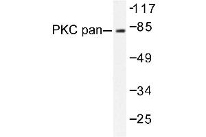 Image no. 1 for anti-Protein Kinase C, alpha (PKCa) antibody (ABIN272065) (PKC alpha Antikörper)