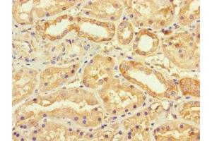 Immunohistochemistry of paraffin-embedded human kidney tissue using ABIN7175490 at dilution of 1:100 (SEC22A Antikörper  (AA 10-187))