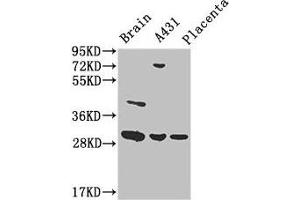 Western Blot Positive WB detected in: Mouse brain tissue, A431 whole cell lysate, Human placenta tissue All lanes: YWHAG antibody at 3. (14-3-3 gamma Antikörper  (AA 113-194))