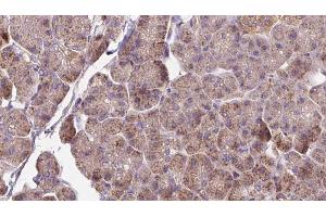 ABIN6273279 at 1/100 staining Human pancreas cancer tissue by IHC-P. (OMA1 Antikörper  (Internal Region))