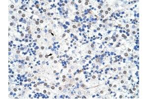 IKZF3 antibody was used for immunohistochemistry at a concentration of 4-8 ug/ml to stain Hepatocytes (arrows) in Human Liver. (IKZF3 Antikörper  (N-Term))
