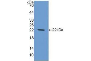 Detection of Recombinant NOS1, Mouse using Polyclonal Antibody to Nitric Oxide Synthase 1, Neuronal (NOS1)