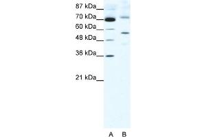 WB Suggested Anti-SIRT3 Antibody Titration:  2. (SIRT3 Antikörper  (Middle Region))