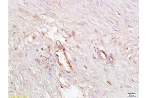 Formalin-fixed and paraffin embedded human endometrial tissue labeled with Anti ICAM4 Polyclonal Antibody, Unconjugated (ABIN873300) at 1:200 followed by conjugation to the secondary antibody and DAB staining