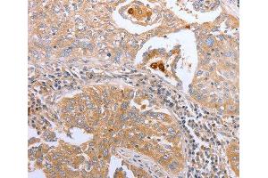 Immunohistochemistry (IHC) image for anti-Cyclin-Dependent Kinase 20 (CDK20) antibody (ABIN3016460) (CCRK Antikörper)