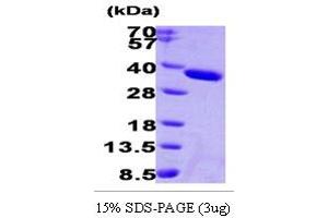 SDS-PAGE (SDS) image for Esterase D (ESD) (AA 1-282) protein (His tag) (ABIN666893)