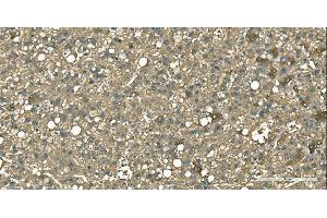 IHC analysis of Aspartate Aminotransferase/GOT1 using anti-Aspartate Aminotransferase/GOT1 antibody (ABIN7601883).