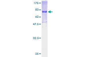 GDI1 Protein (AA 1-447) (GST tag)