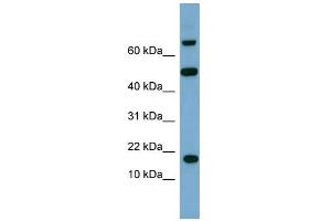 WB Suggested Anti-TSC22D1 Antibody Titration:  0.