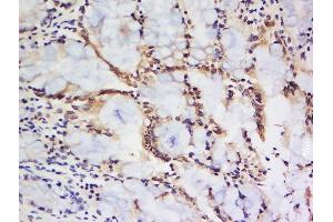 Formalin-fixed and paraffin embedded rat small intestine labeled with Anti Tsukushin/LRRC54 Polyclonal Antibody, Unconjugated  at 1:200 followed by conjugation to the secondary antibody and DAB staining (TSKU Antikörper  (AA 231-300))