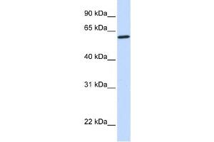 Western Blotting (WB) image for anti-Cytochrome P450, Family 27, Subfamily A, Polypeptide 1 (CYP27A1) antibody (ABIN2459496)