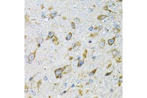 Immunohistochemistry of paraffin-embedded mouse brain using PDYN antibody (ABIN6129606, ABIN6145418, ABIN6145419 and ABIN6221524) at dilution of 1:100 (40x lens). (PDYN Antikörper  (AA 21-254))