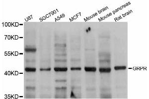 Western blot analysis of extracts of various cell lines, using GRPR antibody. (GRPR Antikörper)