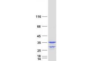 Validation with Western Blot (MMACHC Protein (Myc-DYKDDDDK Tag))