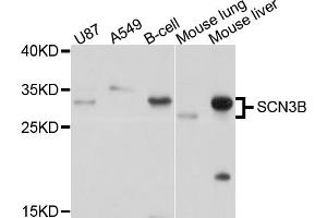 Western blot analysis of extracts of various cell lines, using SCN3B antibody (ABIN4905097) at 1:1000 dilution. (SCN3B Antikörper)